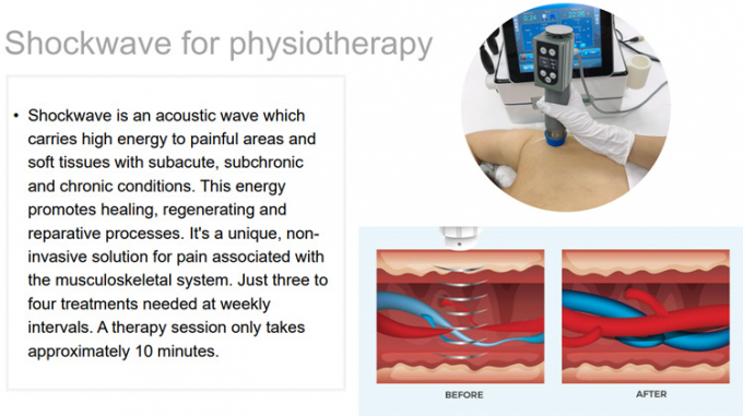 extracorporeal物理療法/衝撃波療法装置/衝撃波療法tecar療法の痛みの軽減